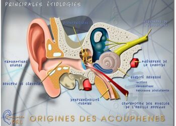 Dieu mes acouphènes !